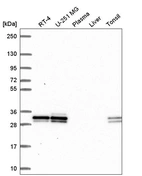 Anti-UBE2R2 Antibody