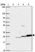 Lane 1: Marker [kDa] 250, 130, 95, 72, 55, 36, 28, 17, 10_br/_Lane 2: Human cell line RT-4_br/_Lane 3: Human cell line U-251 MG_br/_Lane 4: Human plasma_br/_Lane 5: Human Liver tissue