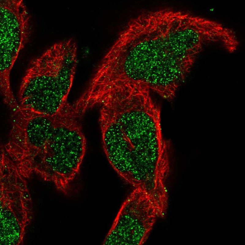 Anti-SMNDC1 Antibody