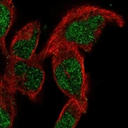 Anti-SMNDC1 Antibody