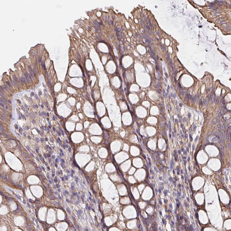 Anti-ARHGEF39 Antibody