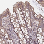 Anti-ARHGEF39 Antibody