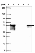 Lane 1: Marker [kDa] 250, 130, 95, 72, 55, 36, 28, 17, 10_br/_Lane 2: Human cell line RT-4_br/_Lane 3: Human cell line U-251 MG_br/_Lane 4: Human plasma_br/_Lane 5: Human Liver tissue