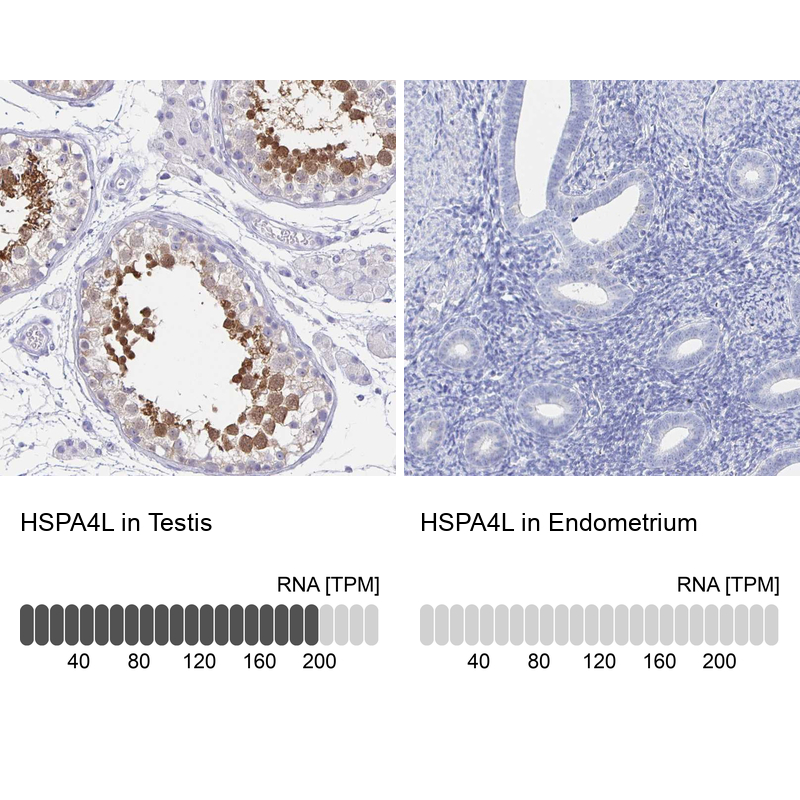Anti-HSPA4L Antibody