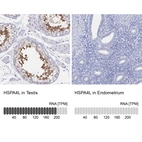Anti-HSPA4L Antibody