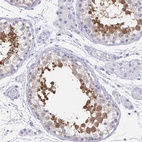 Immunohistochemical staining of human testis shows high expression.