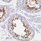 Immunohistochemical staining of human testis shows high expression.