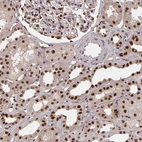 Anti-LAS1L Antibody