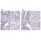 Immunohistochemical staining of human bronchus, colon, fallopian tube and kidney using Anti-ENKUR antibody HPA061503 (A) shows similar protein distribution across tissues to independent antibody HPA037593 (B).