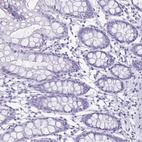 Immunohistochemical staining of human colon shows low expression as expected.