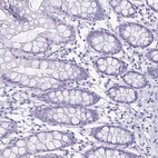 Immunohistochemical staining of human colon shows low expression as expected.
