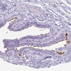Immunohistochemical staining of human fallopian tube shows high expression.