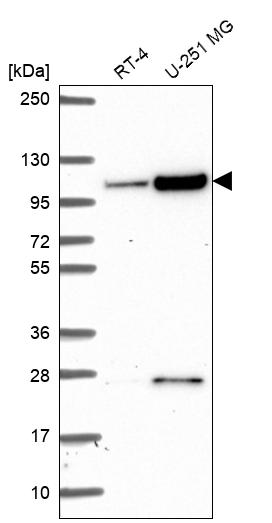 Anti-KIAA1614 Antibody