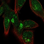 Anti-FPR1 Antibody