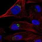 Anti-TPST1 Antibody