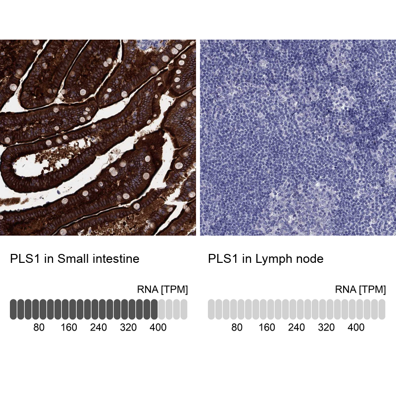 Anti-PLS1 Antibody
