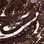 Immunohistochemical staining of human small intestine shows high expression.