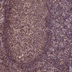 Anti-CSTF2T Antibody