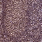 Anti-CSTF2T Antibody