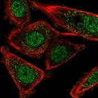 Immunofluorescent staining of human cell line PC-3 shows localization to nucleoplasm & vesicles.