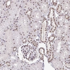 Immunohistochemical staining of human kidney shows moderate to strong nuclear positivity in cells in tubules.