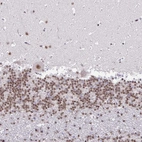 Immunohistochemical staining of human cerebellum shows moderate nuclear positivity in all layers.