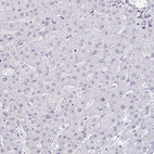 Anti-SIN3A Antibody