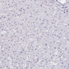 Immunohistochemical staining of human liver shows no positivity in hepatocytes as expected.