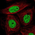 Immunofluorescent staining of human cell line SiHa shows localization to nucleoplasm.
