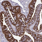 Immunohistochemical staining of human fallopian tube shows strong cytoplasmic/membranous positivity in glandular cells.