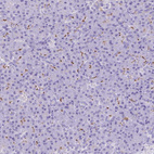 Immunohistochemical staining of human pancreas shows moderate cytoplasmic positivity in exocrine glandular cells.