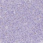 Immunohistochemical staining of human pancreas shows moderate cytoplasmic positivity in exocrine glandular cells.