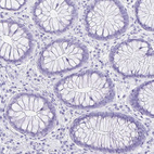 Immunohistochemical staining of human colon shows negative positivity in glandular cells as expected.