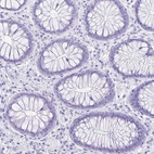 Immunohistochemical staining of human colon shows negative positivity in glandular cells as expected.
