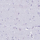 Immunohistochemical staining of human cerebral cortex shows negative positivity in neurons as expected.