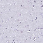 Immunohistochemical staining of human cerebral cortex shows negative positivity in neurons as expected.