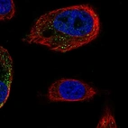 Immunofluorescent staining of human cell line PC-3 shows localization to vesicles.