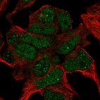 Immunofluorescent staining of human cell line HEK 293 shows localization to nucleoplasm.