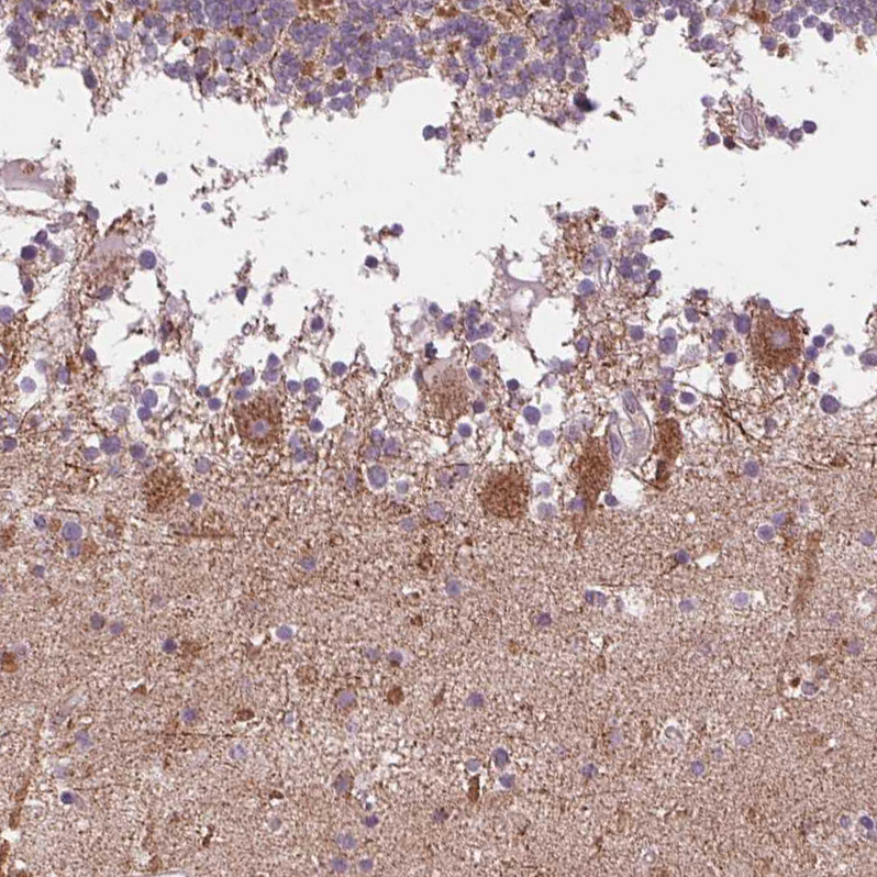 Anti-COX6A1 Antibody