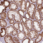 Immunohistochemical staining of human kidney shows moderate granular cytoplasmic positivity in cells in tubules.