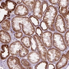 Immunohistochemical staining of human kidney shows moderate granular cytoplasmic positivity in cells in tubules.