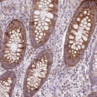 Immunohistochemical staining of human colon shows moderate granular cytoplasmic positivity in glandular cells.