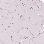 Immunohistochemical staining of human skeletal muscle shows no positivity in myocytes as expected.