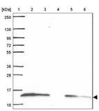 Lane 1: Marker [kDa] 250, 130, 95, 72, 55, 36, 28, 17, 10_br/_Lane 2: Human cell line RT-4_br/_Lane 3: Human cell line U-251 MG_br/_Lane 4: Human plasma_br/_Lane 5: Human Liver tissue_br/_Lane 6: Human Tonsil tissue
