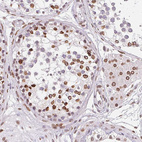 Immunohistochemical staining of human testis shows strong positivity in the nuclear membrane in cells in seminiferous ducts.