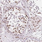 Immunohistochemical staining of human testis shows strong positivity in the nuclear membrane in cells in seminiferous ducts.