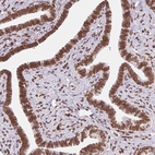 Immunohistochemical staining of human fallopian tube shows strong positivity in the nuclear membrane in glandular cells.
