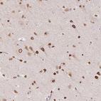 Immunohistochemical staining of human cerebral cortex shows strong positivity in the nuclear membrane in neuronal cells.