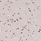 Immunohistochemical staining of human cerebral cortex shows strong positivity in the nuclear membrane in neuronal cells.