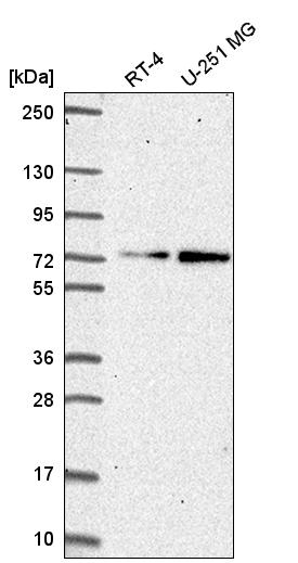 Anti-ZNF616 Antibody